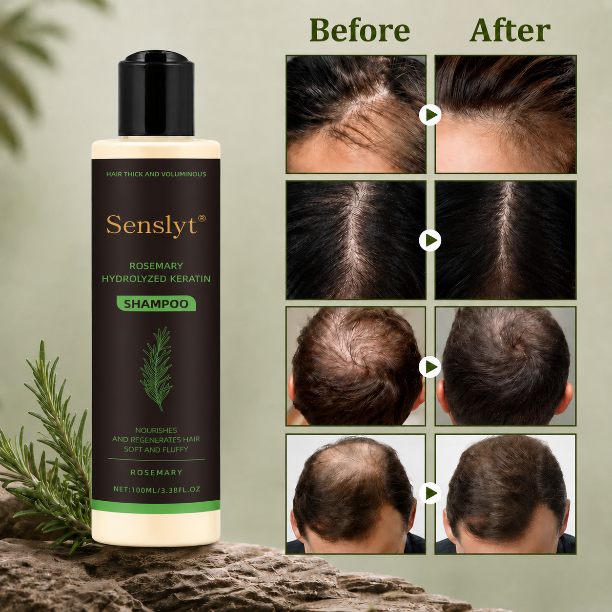 Senslyt® Rosemary Shampoo | Hair Growth & Anti-Dandruff Scalp Treatment