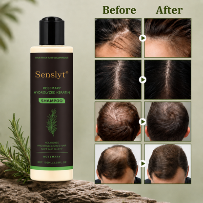 Senslyt® Rosemary Shampoo | Hair Growth & Anti-Dandruff Scalp Treatment