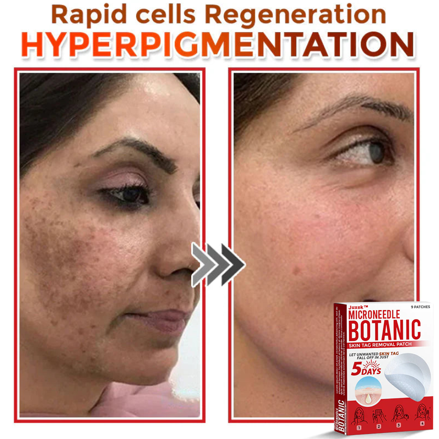 Juxek™ Removal Patch