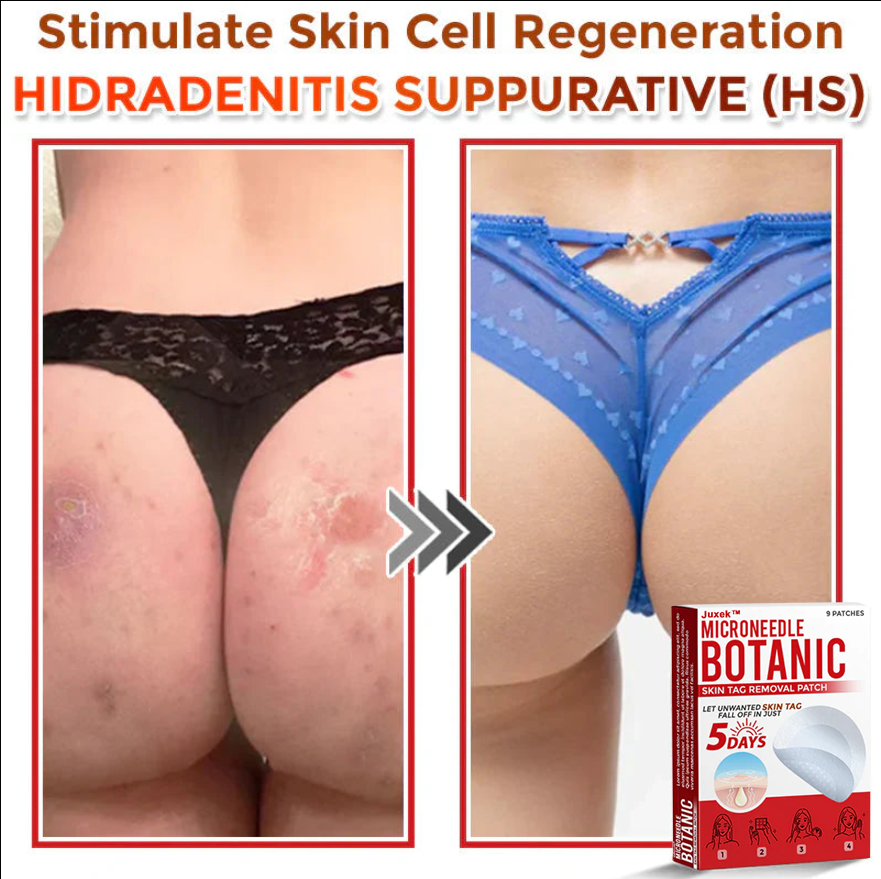 Juxek™ Removal Patch