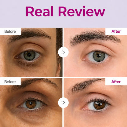 Calcium Factor Concealer Eye Cream