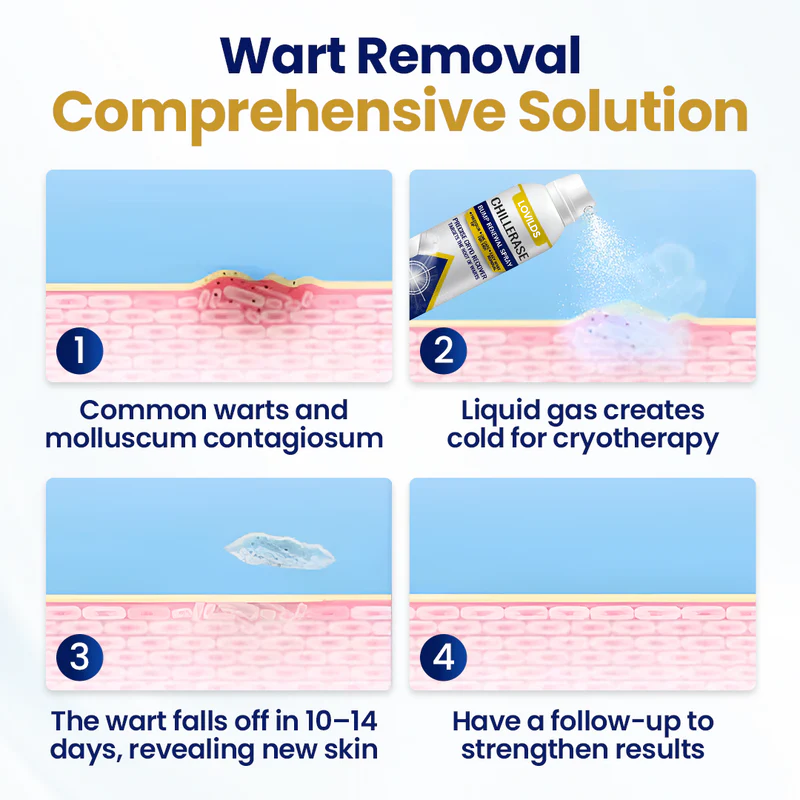 LOVILDS™ ChillErase Bump Renewal Spray🔥