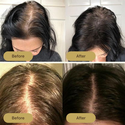 Slimoly Growth Natural Hair Growth Oil