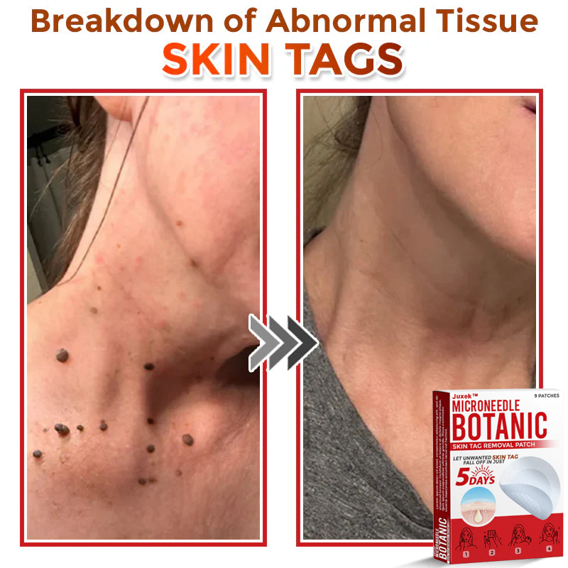 Juxek Removal Patch a