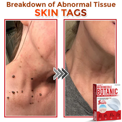 Juxek Removal Patch a