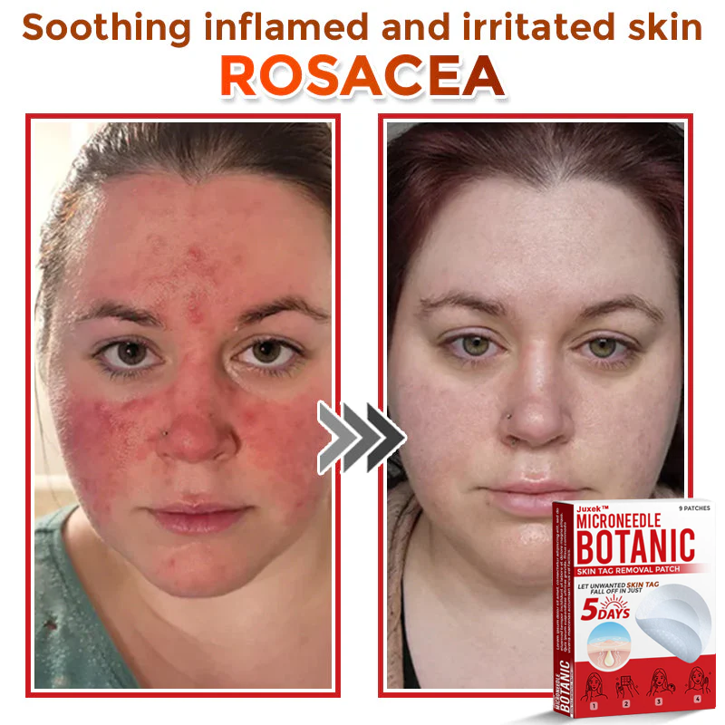 Juxek™ Removal Patch