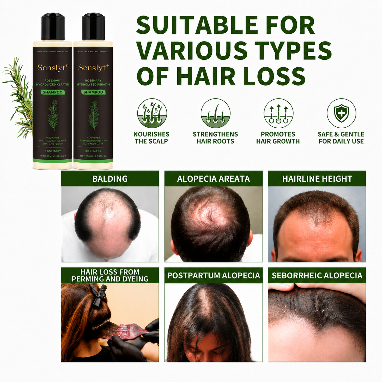 Senslyt® Rosemary Shampoo | Hair Growth & Anti-Dandruff Scalp Treatment