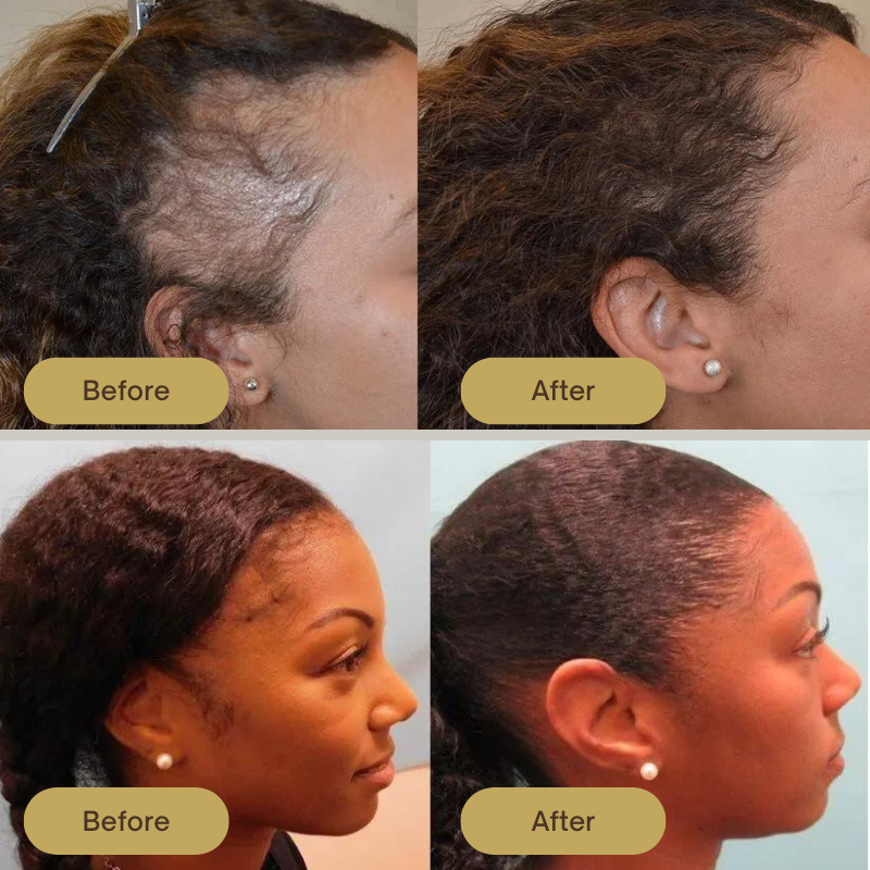 Slimoly Growth Natural Hair Growth Oil