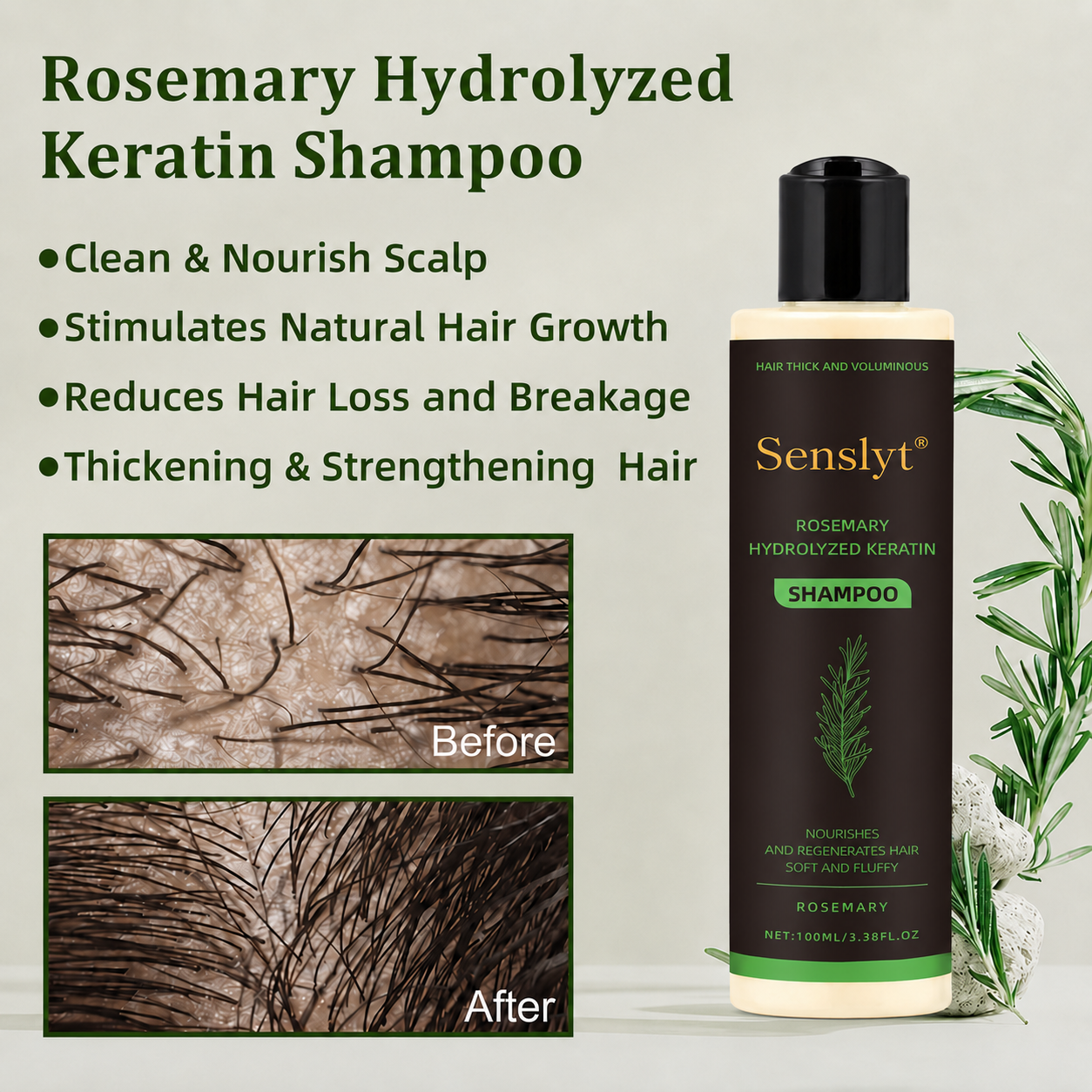 Senslyt® Rosemary Shampoo | Hair Growth & Anti-Dandruff Scalp Treatment