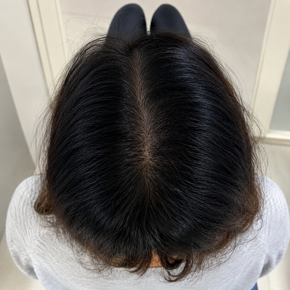 After